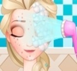 Jogo A Acne da Princesa Elsa no Joguix